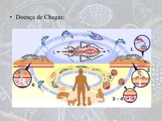 • Doença de Chagas:
 