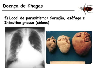 Doença de Chagas
f) Local de parasitismo: Coração, esôfago e
Intestino grosso (cólons).
 