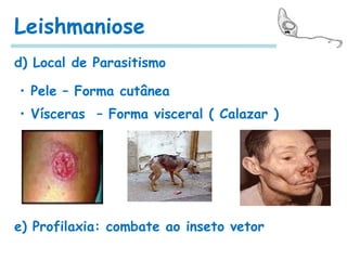 Leishmaniose
d) Local de Parasitismo
• Pele – Forma cutânea
• Vísceras – Forma visceral ( Calazar )
e) Profilaxia: combate ao inseto vetor
 