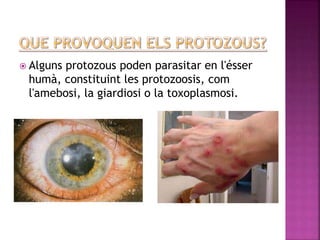  Alguns protozous poden parasitar en l'ésser
humà, constituint les protozoosis, com
l'amebosi, la giardiosi o la toxoplasmosi.
 