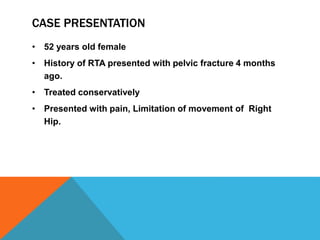 CASE PRESENTATION
• 52 years old female
• History of RTA presented with pelvic fracture 4 months
ago.
• Treated conservatively
• Presented with pain, Limitation of movement of Right
Hip.
 