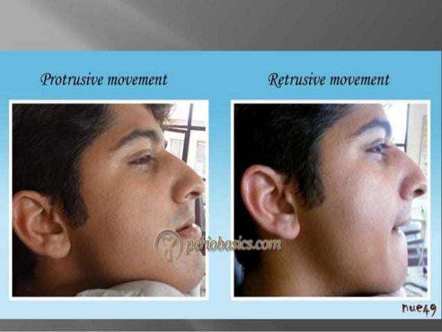 protrusive movements mandibular