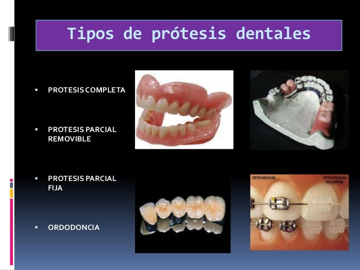 Protesis