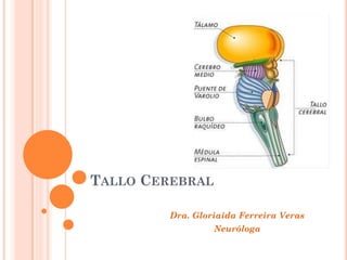 TALLO CEREBRAL
Dra. Gloriaida Ferreira Veras
Neuróloga
 