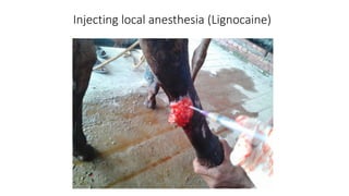 Injecting local anesthesia (Lignocaine)
 