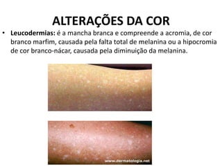 Prova 1 - dermatologia (lesões elementares, semiologia, exames e sinais ...