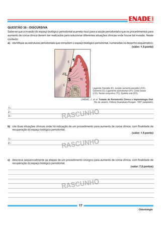 17
Odontologia
QUESTÃO 38 - DISCURSIVA
Sabe-se que a invasão do espaço biológico periodontal acarreta risco para a saúde periodontal e que os procedimentos para
aumento de coroa clínica devem ser realizados para solucionar diferentes situações clínicas onde houve tal invasão. Neste
contexto:
a) identifique as estruturas periodontais que compõem o espaço biológico periodontal, numeradas no desenho esquemático;
(valor: 1,5 ponto)
b) cite duas situações clínicas onde há indicação de um procedimento para aumento de coroa clínica, com finalidade de
recuperação do espaço biológico periodontal;
(valor: 1,5 ponto)
c) descreva seqüencialmente as etapas de um procedimento cirúrgico para aumento de coroa clínica, com finalidade de
recuperação do espaço biológico periodontal.
(valor: 7,0 pontos)
RASCUNHO
1 -
2 -
3 -
RASCUNHO
1 -
2 -
RASCUNHO
Legenda: Esmalte (E); Junção cemento-esmalte (JCE);
Cemento (C); Ligamento periodontal (LP); Crista óssea
(CO); Tecido conjuntivo (TC); Epitélio oral (EO).
LINDHE, J. et al. Tratado de Periodontia Clínica e Implantologia Oral.
Rio de Janeiro, Editora Guanabara Koogan: 1997 (adaptado).
 
