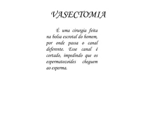 VASECTOMIA
É uma cirurgia feita
na bolsa escrotal do homem,
por onde passa o canal
deferente. Esse canal é
cortado, impedindo que os
espermatozoides cheguem
ao esperma.
 