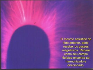 O mesmo assistido da foto anterior, após receber os passes magnéticos. Repare como seu campo fluídico encontra-se harmonizado e direcionado. 