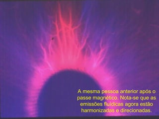 A mesma pessoa anterior após o passe magnético. Nota-se que as emissões fluídicas agora estão harmonizadas e direcionadas. 