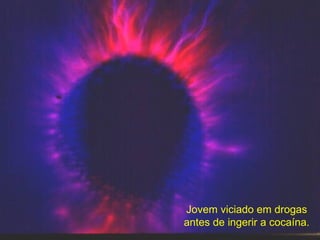 Jovem viciado em drogas antes de ingerir a cocaína. 