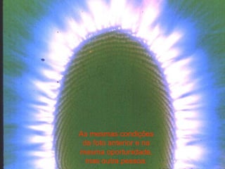 As mesmas condições da foto anterior e na mesma oportunidade, mas outra pessoa. 