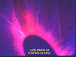 Outra criança da mesma faixa etária. 