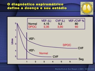 O diagnóstico espirométrico
define a doença e seu estádio
Roche NRoche N et alet al. Eur Respir J 2001; 18:903-908. Eur Respir J 2001; 18:903-908
 