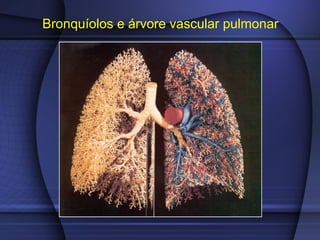 Bronquíolos e árvore vascular pulmonar
 