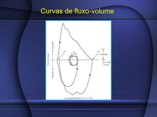 Curvas de fluxo-volume
 