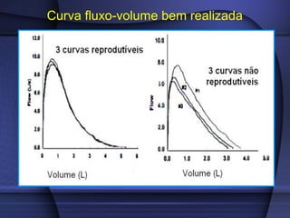Curva fluxo-volume bem realizada
 