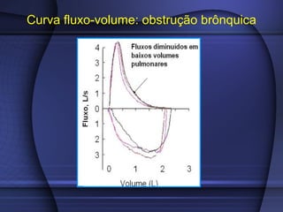 Curva fluxo-volume: obstrução brônquica
 