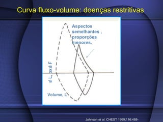 Curva fluxo-volume: doenças restritivas
Johnson et al. CHEST 1999;116:488-
Volume, L
Fluxo,L/s
Aspectos
semelhantes ,
proporções
menores.
 