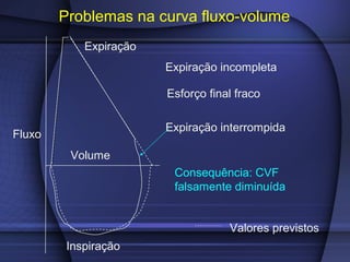 Fluxo
Problemas na curva fluxo-volume
Expiração
Inspiração
Expiração incompleta
Esforço final fraco
Expiração interrompida
Volume
Consequência: CVF
falsamente diminuída
Valores previstos
 