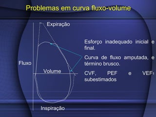 Problemas em curva fluxo-volume
Expiração
Fluxo
Volume
Inspiração
Esforço inadequado inicial e
final.
Curva de fluxo amputada, e
término brusco.
CVF, PEF e VEF1
subestimados
 