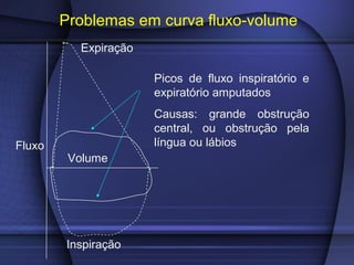 Problemas em curva fluxo-volume
Expiração
Fluxo
Volume
Inspiração
Picos de fluxo inspiratório e
expiratório amputados
Causas: grande obstrução
central, ou obstrução pela
língua ou lábios
 