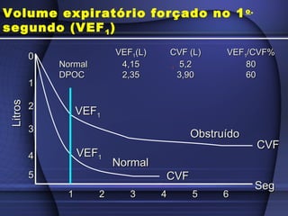 00
55
11
44
22
33
LitrosLitros
11 6655443322
CVFCVF
CVFCVF
VEFVEF11
VEFVEF11
NormalNormal
ObstruídoObstruído
1
SegSeg
VEFVEF11(L)(L) CVF (L)CVF (L) VEFVEF11/CVF%/CVF%
NormalNormal 4,154,15 5,25,2 8080
DPOCDPOC 2,352,35 3,903,90 6060
Volume expiratório forçado no 1o.
segundo (VEF1)
 