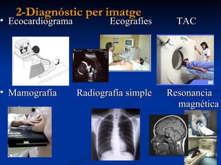 2-Diagnóstic per imatge <ul><li>Ecocardiograma  Ecografíes  TAC  </li></ul><ul><li>Mamografía  Radiografía simple  Resonan...