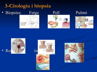 3-Citología i biopsia <ul><li>Biopsies:  Fetge  Pell  Pulmó  </li></ul><ul><li>Ronyó  tiroides  Úter  </li></ul><ul><li>Ci...