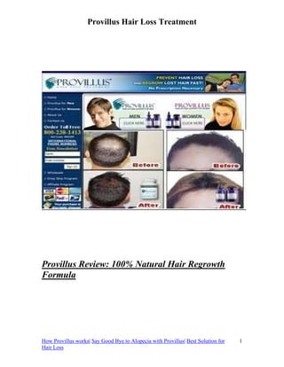 Provillus Hair Loss Treatment




Provillus Review: 100% Natural Hair Regrowth
Formula




How Provillus works| Say Good Bye to Alopecia with Provillus| Best Solution for   1
Hair Loss
 
