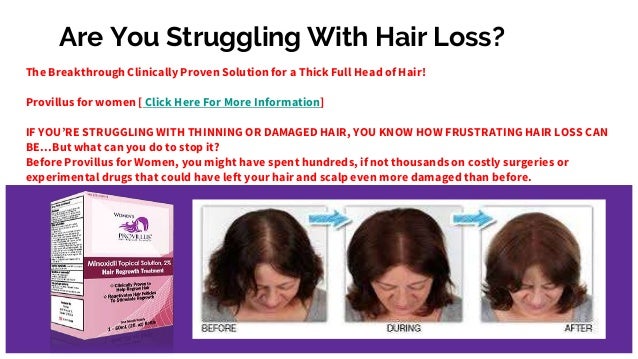 Provillus Reviews Thinning Hair Growth Treatment