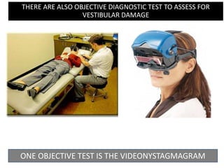 THERE ARE ALSO OBJECTIVE DIAGNOSTIC TEST TO ASSESS FOR
VESTIBULAR DAMAGE
ONE OBJECTIVE TEST IS THE VIDEONYSTAGMAGRAM
 