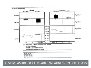 TEST MEASURES & COMPARES WEAKNESS IN BOTH EARS
 