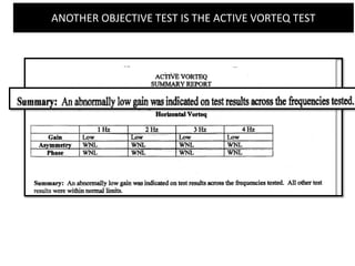 ANOTHER OBJECTIVE TEST IS THE ACTIVE VORTEQ TEST
 