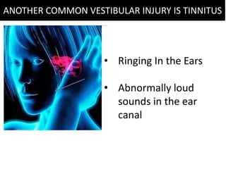 • Ringing In the Ears
• Abnormally loud
sounds in the ear
canal
ANOTHER COMMON VESTIBULAR INJURY IS TINNITUS
 