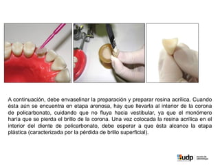 A continuación, debe envaselinar la preparación y preparar resina acrílica. Cuando
ésta aún se encuentra en etapa arenosa, hay que llevarla al interior de la corona
de policarbonato, cuidando que no fluya hacia vestibular, ya que el monómero
haría que se pierda el brillo de la corona. Una vez colocada la resina acrílica en el
interior del diente de policarbonato, debe esperar a que ésta alcance la etapa
plástica (caracterizada por la pérdida de brillo superficial).
 