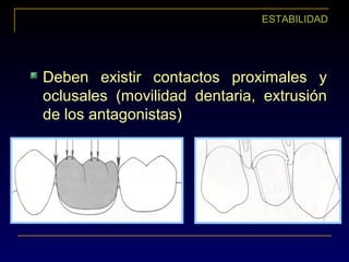 ESTABILIDAD
Deben existir contactos proximales y
oclusales (movilidad dentaria, extrusión
de los antagonistas)
 