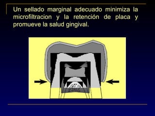 Un sellado marginal adecuado minimiza la
microfiltracion y la retención de placa y
promueve la salud gingival.
 