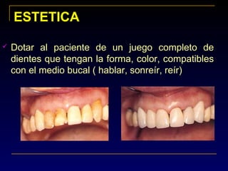 ESTETICAESTETICA
 Dotar al paciente de un juego completo de
dientes que tengan la forma, color, compatibles
con el medio bucal ( hablar, sonreír, reír)
 