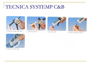 TECNICA SYSTEMP C&B
 
