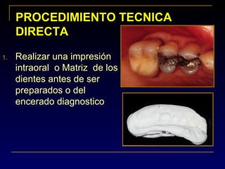 PROCEDIMIENTO TECNICAPROCEDIMIENTO TECNICA
DIRECTADIRECTA
1. Realizar una impresión
intraoral o Matriz de los
dientes antes de ser
preparados o del
encerado diagnostico
 