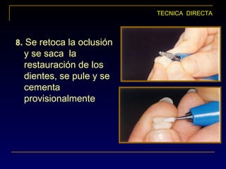 8. Se retoca la oclusión
y se saca la
restauración de los
dientes, se pule y se
cementa
provisionalmente
TECNICA DIRECTA
 