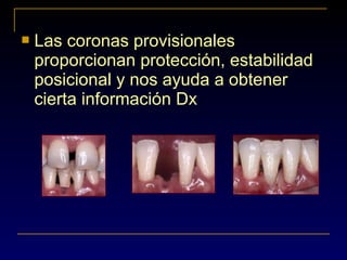  Las coronas provisionales
proporcionan protección, estabilidad
posicional y nos ayuda a obtener
cierta información Dx
 