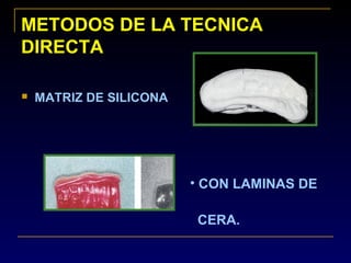 METODOS DE LA TECNICAMETODOS DE LA TECNICA
DIRECTADIRECTA
 MATRIZ DE SILICONA
• CON LAMINAS DE
CERA.
 