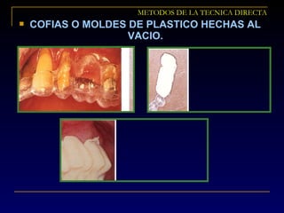  COFIAS O MOLDES DE PLASTICO HECHAS AL
VACIO.
METODOS DE LA TECNICA DIRECTA
 