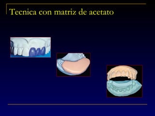 Tecnica con matriz de acetato
 