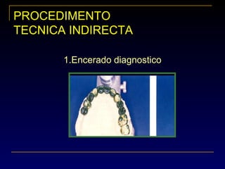 PROCEDIMENTOPROCEDIMENTO
TECNICA INDIRECTATECNICA INDIRECTA
1.Encerado diagnostico
 