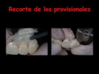 Recorte de los provisionales
 