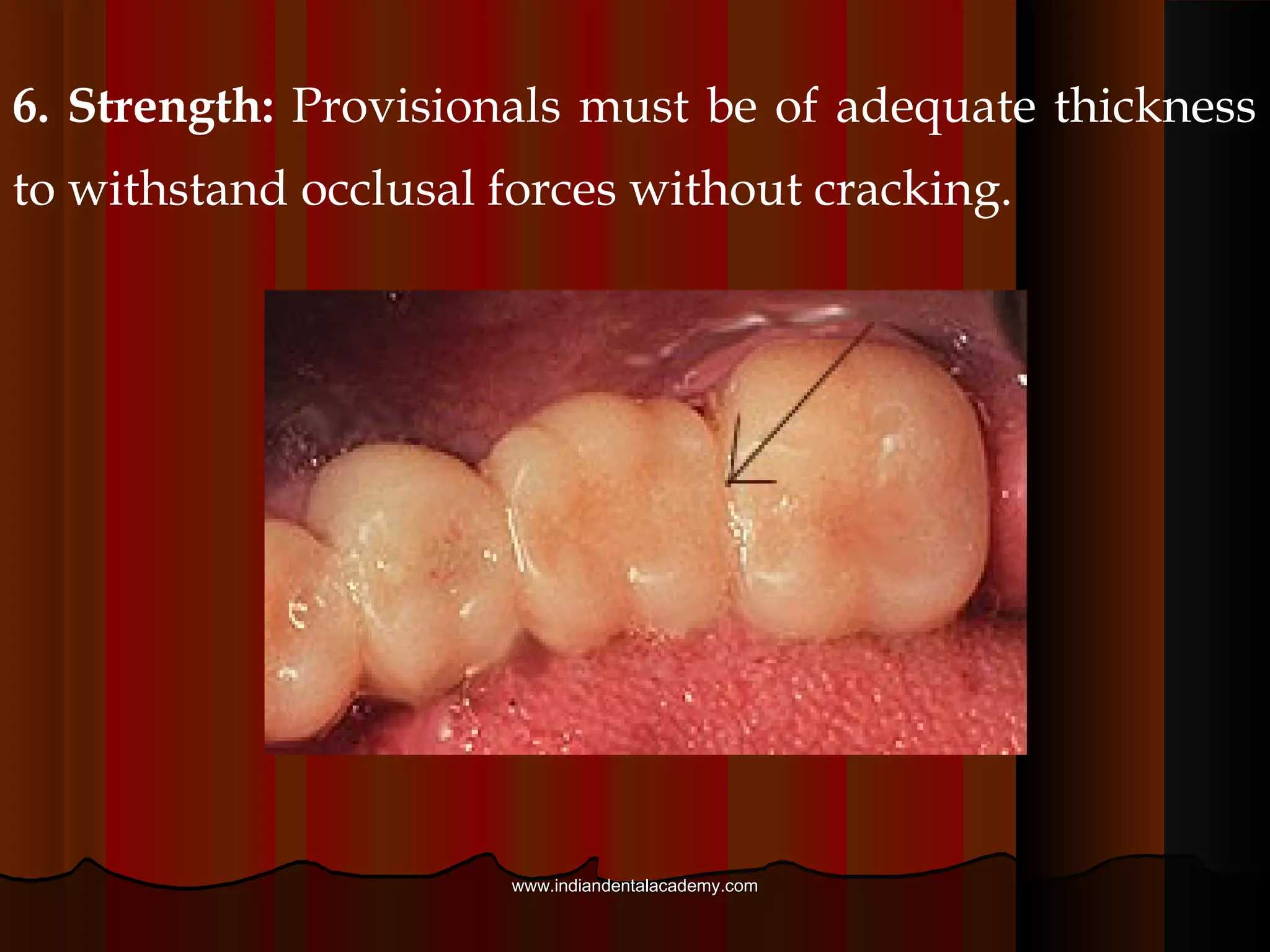 The photo at right
shows an improperly
contoured fixed partial
denture.
www.indiandentalacademy.comwww.indiandentalacademy.com
 