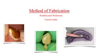 Method of Fabrication
Prefabricated/ Preformed.
Custom made.
 